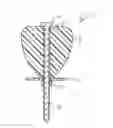 Fig. 01 - METHOD AND APPARATUS FOR INTRAOSSEOUS INFUSION