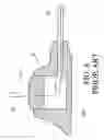 Fig. 10 - Totally implantable central venous access port