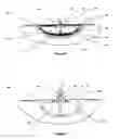 Fig. 07 - Wound cleansing apparatus with stress