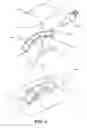 Fig. 05 - Closed incision negative pressure wound therapy device and methods of use
