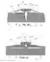 Fig. 08 - Closed incision negative pressure wound therapy device and methods of use