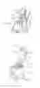 Fig. 13 - Device for introducing medicine into an infusion container