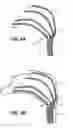 Fig. 05 - Device and methods for treating paranasal sinus conditions