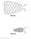 Fig. 06 - Device and methods for treating paranasal sinus conditions