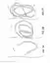 Fig. 08 - Device and methods for treating paranasal sinus conditions