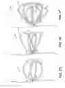 Fig. 09 - Device and methods for treating paranasal sinus conditions