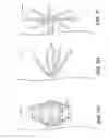Fig. 10 - Device and methods for treating paranasal sinus conditions