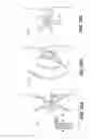 Fig. 18 - Device and methods for treating paranasal sinus conditions