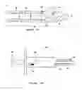 Fig. 03 - Sinus delivery of sustained release therapeutics