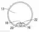 Fig. 01 - Catheter Having an Expandable Lumen and Method of Manufacture