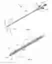 Fig. 02 - Pressure Sensing Catheter