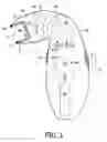 Fig. 02 - Photo-epilation device