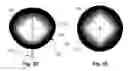 Fig. 10 - Methods and devices for delivering microwave energy