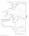 Fig. 04 - Orthopedic surgical device