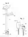 Fig. 11 - Tool for use with a bone anchor, in particular for spinal surgery