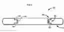 Fig. 07 - Systems and methods for treating obesity and type 2 diabetes