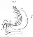 Fig. 16 - Systems and methods for treating obesity and type 2 diabetes
