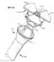 Fig. 26 - Systems and methods for treating obesity and type 2 diabetes