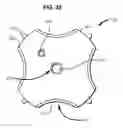 Fig. 34 - Systems and methods for treating obesity and type 2 diabetes