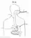 Fig. 36 - Systems and methods for treating obesity and type 2 diabetes