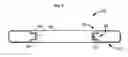 Fig. 07 - Systems and methods for treating obesity and type 2 diabetes