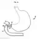 Fig. 18 - Systems and methods for treating obesity and type 2 diabetes