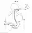 Fig. 35 - Systems and methods for treating obesity and type 2 diabetes
