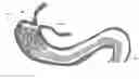 Fig. 01 - Atraumatic Gastrointestinal Anchor