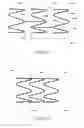 Fig. 06 - Atraumatic Gastrointestinal Anchor