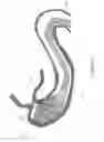 Fig. 09 - Atraumatic Gastrointestinal Anchor