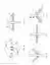 Fig. 07 - Percutaneous Gastroplasty