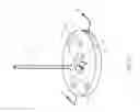 Fig. 08 - Percutaneous Gastroplasty