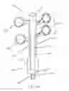 Fig. 14 - Percutaneous Gastroplasty