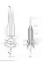 Fig. 15 - Percutaneous Gastroplasty