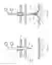 Fig. 16 - Percutaneous Gastroplasty