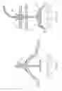Fig. 17 - Percutaneous Gastroplasty