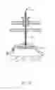 Fig. 18 - Percutaneous Gastroplasty