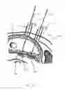 Fig. 22 - Percutaneous Gastroplasty