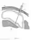 Fig. 27 - Percutaneous Gastroplasty