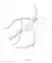 Fig. 29 - Percutaneous Gastroplasty