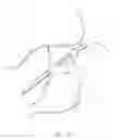 Fig. 30 - Percutaneous Gastroplasty