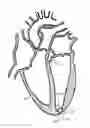 Fig. 01 - TRANSAPICAL HEART PORT
