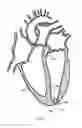 Fig. 02 - TRANSAPICAL HEART PORT