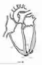 Fig. 04 - TRANSAPICAL HEART PORT