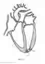 Fig. 05 - TRANSAPICAL HEART PORT