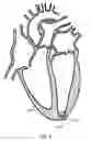 Fig. 08 - TRANSAPICAL HEART PORT