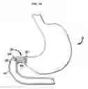 Fig. 18 - Systems and Methods for Treating Obesity and Type 2 Diabetes