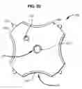 Fig. 34 - Systems and Methods for Treating Obesity and Type 2 Diabetes