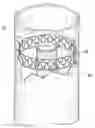 Fig. 01 - Minimal surface area contact device for holding plaque to blood vessel wall