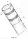 Fig. 10 - Minimal surface area contact device for holding plaque to blood vessel wall